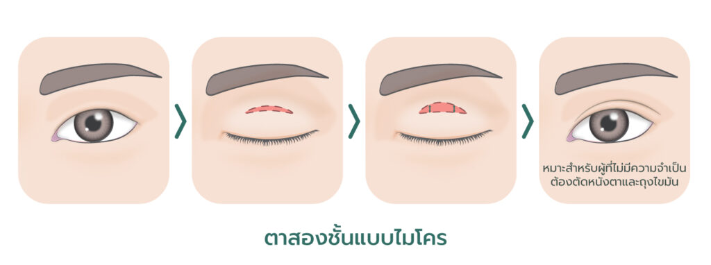ทำตาสองชั้น
