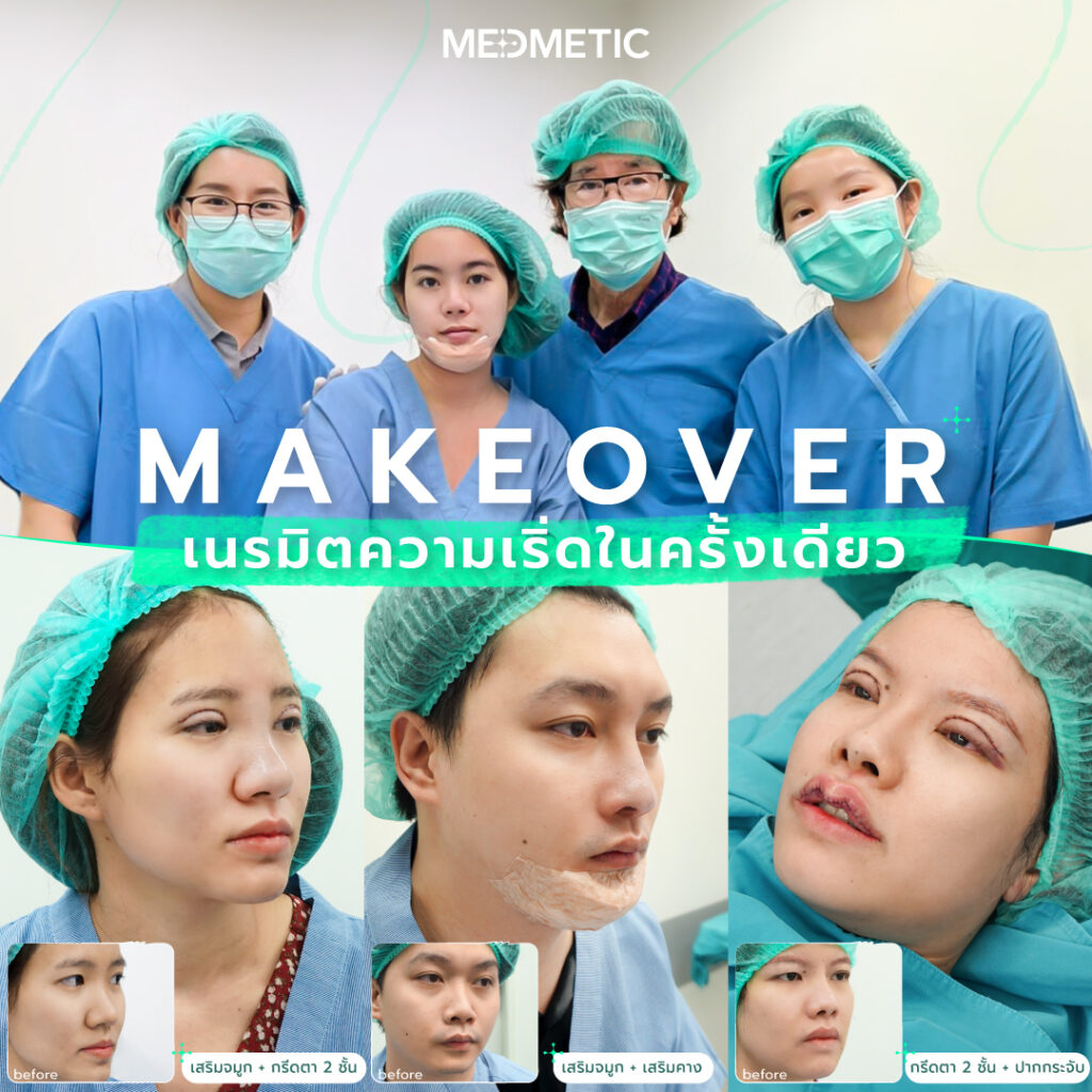 ทําตาสองชั้นที่ไหนดี2021