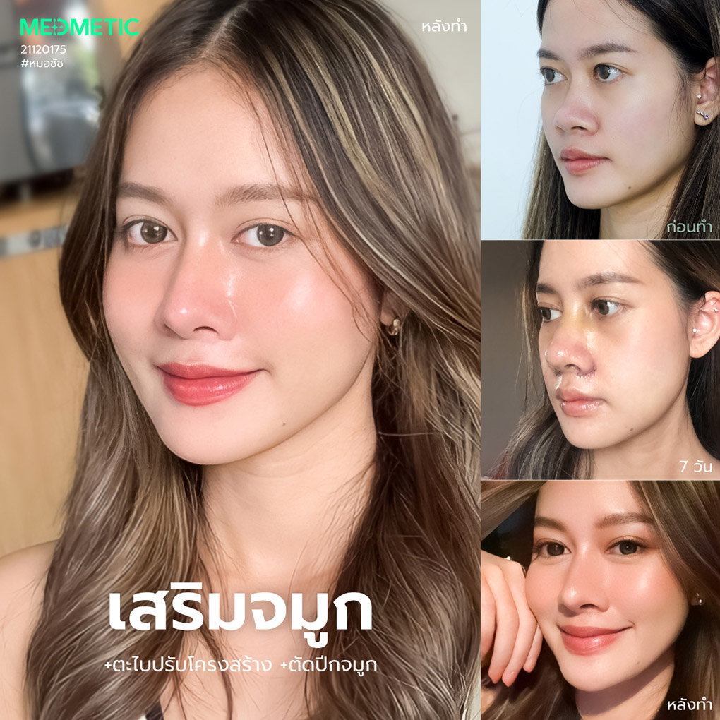 จมูกทรงสโลปปลายพุ่งหยดน้ำ